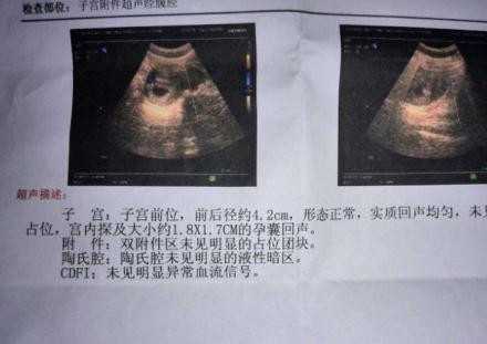 代孕35天出血能保住吗_台湾，香港代孕合法吗