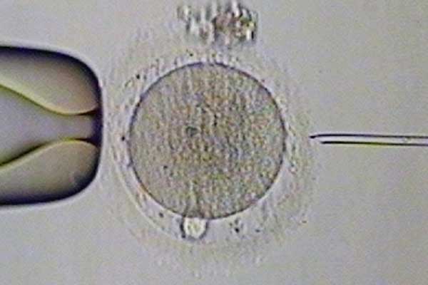 太原借卵生子的费用_俄罗斯试管婴儿基因检测对囊胚会有伤害吗？